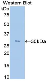 ANGPTL4 Antibody (aa182-394)
