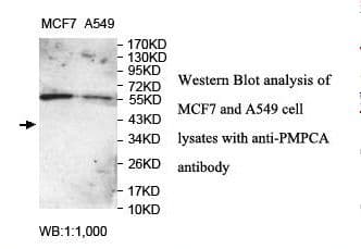 PMPCA Antibody (aa186-370)