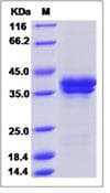 Monkey-Rhesus IL17A+IL17F Protein (Recombinant His,C-terminus)