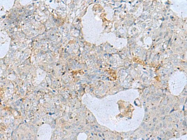 NAGK Antibody