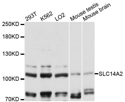 Polyclonal Rabbit anti-Human SLC14A2 / UTR Antibody (WB)