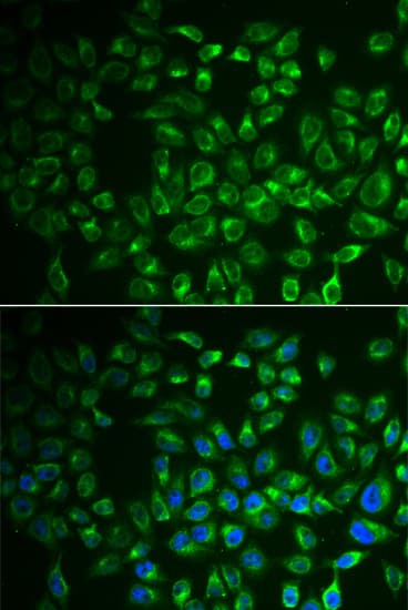 IHC-plus™ I-BABP / FABP6 Antibody