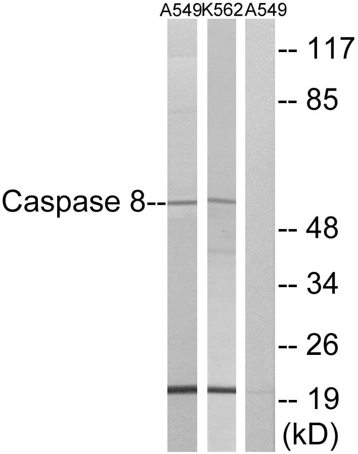 IHC-plus™ CASP8 / Caspase 8 Antibody (aa313-362)