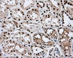 APP / Beta Amyloid Precursor Antibody (clone OTI5F1)