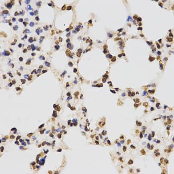 Histone H3 Antibody (Asym-Di-Methyl-Arg17)