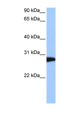 NSF Antibody (aa662-711)
