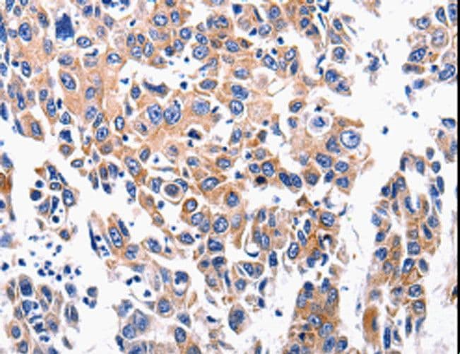 Polyclonal Rabbit anti-Human ACE2 / ACE-2 Antibody (IHC)