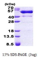 Human PSTPIP1 Protein (Recombinant His)