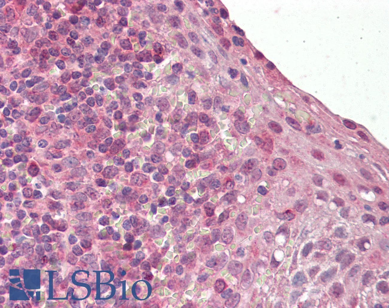 IHC-plus™ Polyclonal Goat anti-Human BLIMP1 / PRDM1 Antibody (aa698-711, IHC, IF, WB)