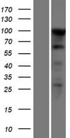 Human PSK / SEZ6L2 Protein (Over-Expression Lysate Myc-DDK (Flag))