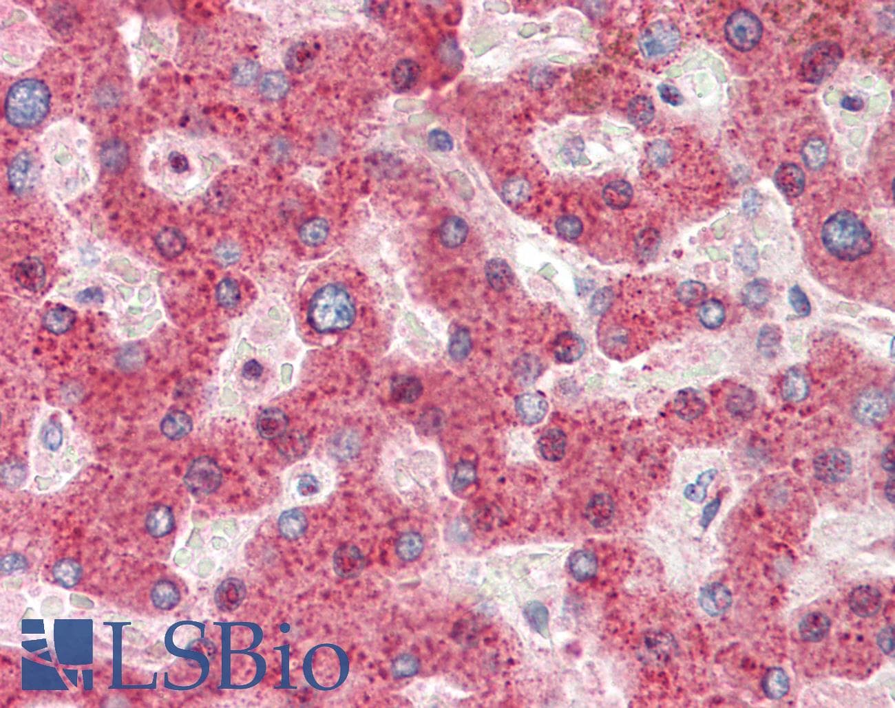 IHC-plus™ HRASLS2 Antibody (aa102-113)