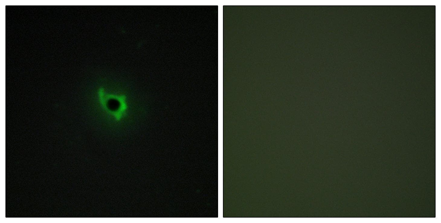 EPHA6 / EPH Receptor A6 Antibody
