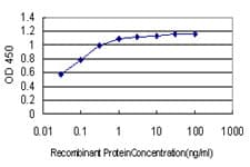 Monoclonal Mouse anti-Human BCL9 Antibody (clone 2D4, IF, WB)
