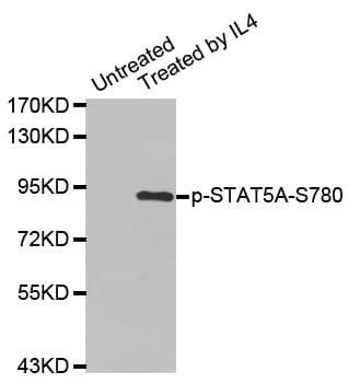 Polyclonal Rabbit anti-Human STAT5A Antibody (phospho-Ser780, WB)