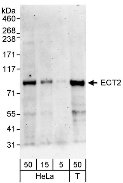 Polyclonal Rabbit anti-Human ECT2 Antibody (aa833-883, WB)