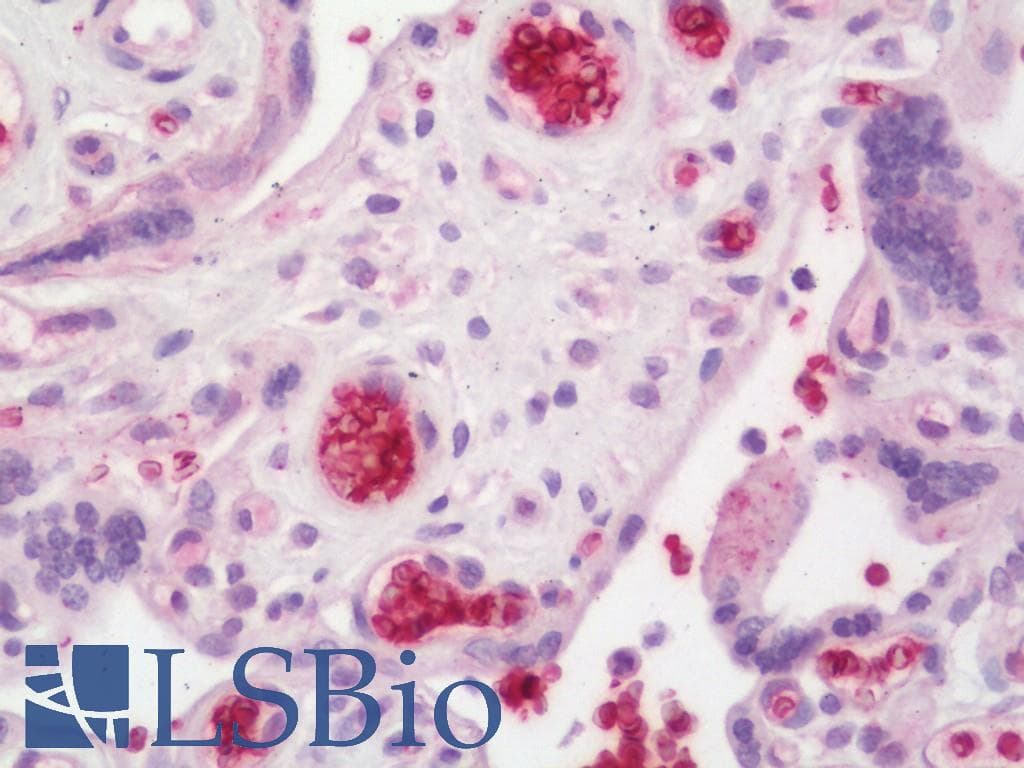IHC-plus™ ANK1 / Ankyrin Antibody (aa1831-1881)