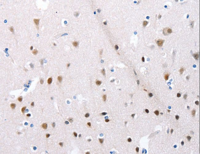 POMC / Proopiomelanocortin Antibody