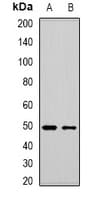 Polyclonal Rabbit anti-Human MBNL1 / MBNL Antibody (IHC, WB)