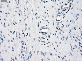 BUB1B / BubR1 Antibody (clone OTI3D9)