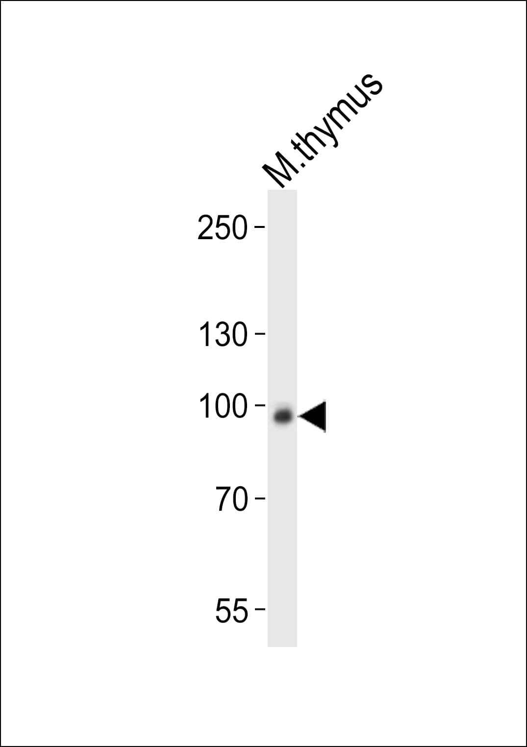 RPS6KA5 / MSK1 Antibody (aa850-883)