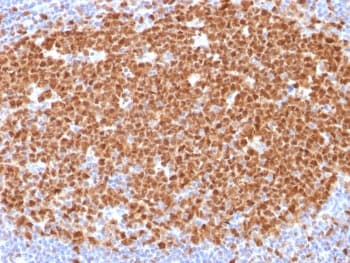 MCM7 Antibody (clone MCM7/1468)