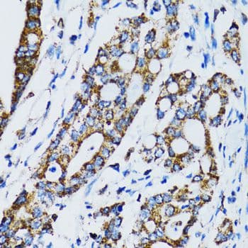 STAT3 Antibody