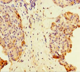 Polyclonal Rabbit anti-Human MAML1 Antibody (IHC)