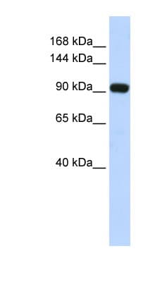 MECOM / EVI1 Antibody (aa359-408)