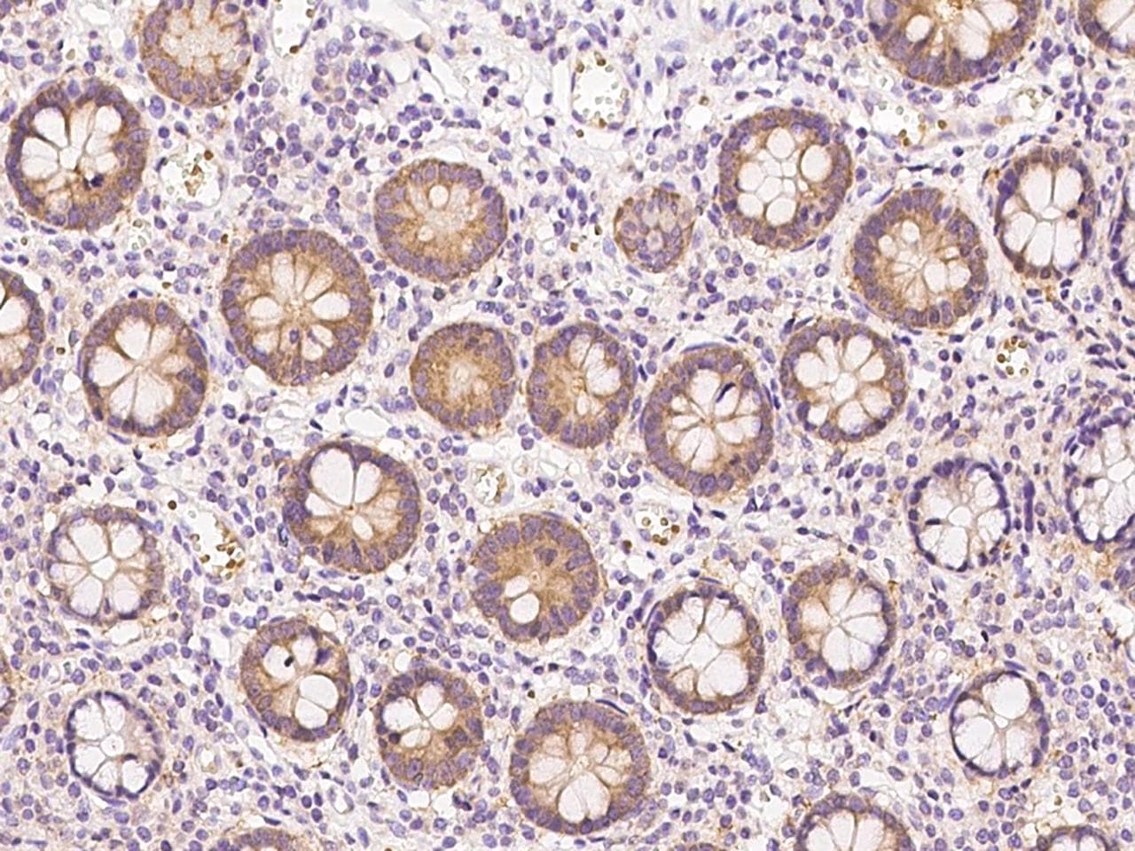 Polyclonal Rabbit anti-Human UMPS / OPRT Antibody (IHC, WB)