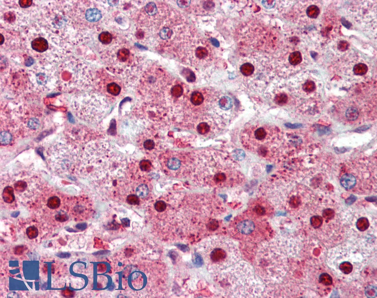 IHC-plus™ PARP1 Antibody (N-Terminus)