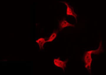 Polyclonal Rabbit anti-Human PDRG1 Antibody (IF, WB)