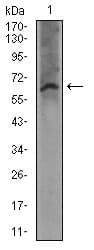 Monoclonal Mouse anti-Human FcERI / Fc Epsilon RI Antibody (clone 1F2A9, aa42-103, WB)