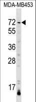 AMIGO3 Antibody (aa242-268)