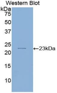 IL11 Antibody (aa22-199, FITC)