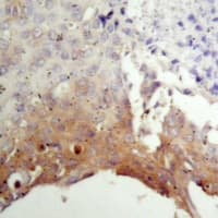 Tuberin / TSC2 Antibody (Internal)