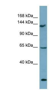 LATS1 Antibody (aa971-1020)