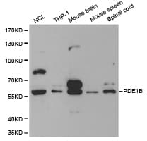 Polyclonal Rabbit anti-Human PDE1B Antibody (IHC, WB)