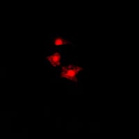Polyclonal Rabbit anti-Human FASTK / FAST Antibody (Internal, IF, WB)
