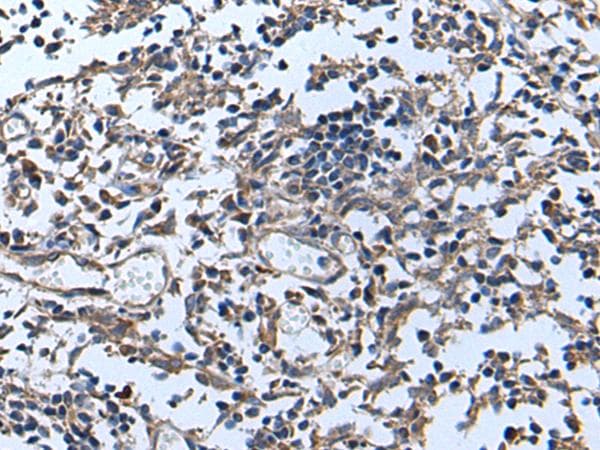 APOD / Apolipoprotein D Antibody