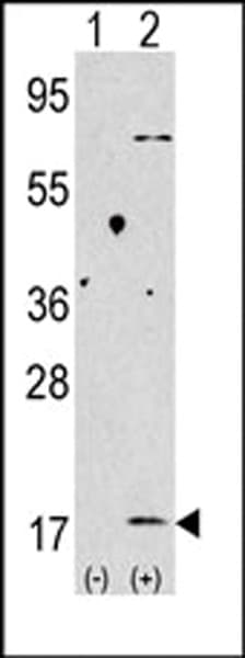 MAP1LC3B / LC3B Antibody (aa77-106)
