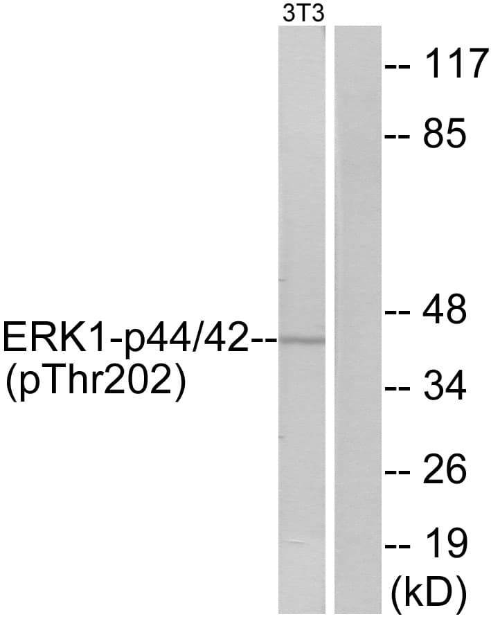 Polyclonal Rabbit anti-Human ERK1 + ERK2 Antibody (phospho-Thr202, WB)