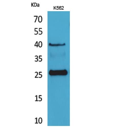 KLRB1 / CD161 Antibody (101-150 aa, Internal)