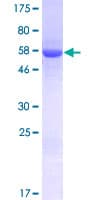 Human UBXD7 Protein (Recombinant GST)