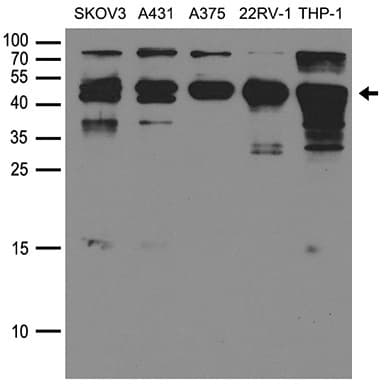 Polyclonal Rabbit anti-Human CD63 Antibody (WB)