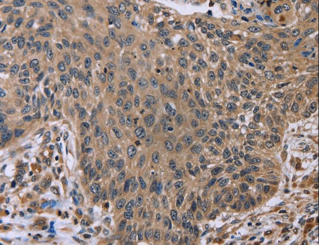 EDA / Ectodysplasin A Antibody