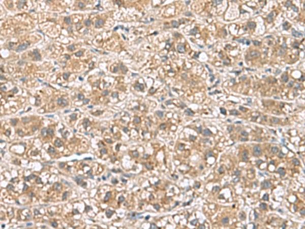 PHLDA3 Antibody