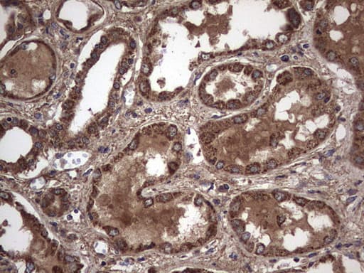 IL1RN Antibody (clone OTI2B1)