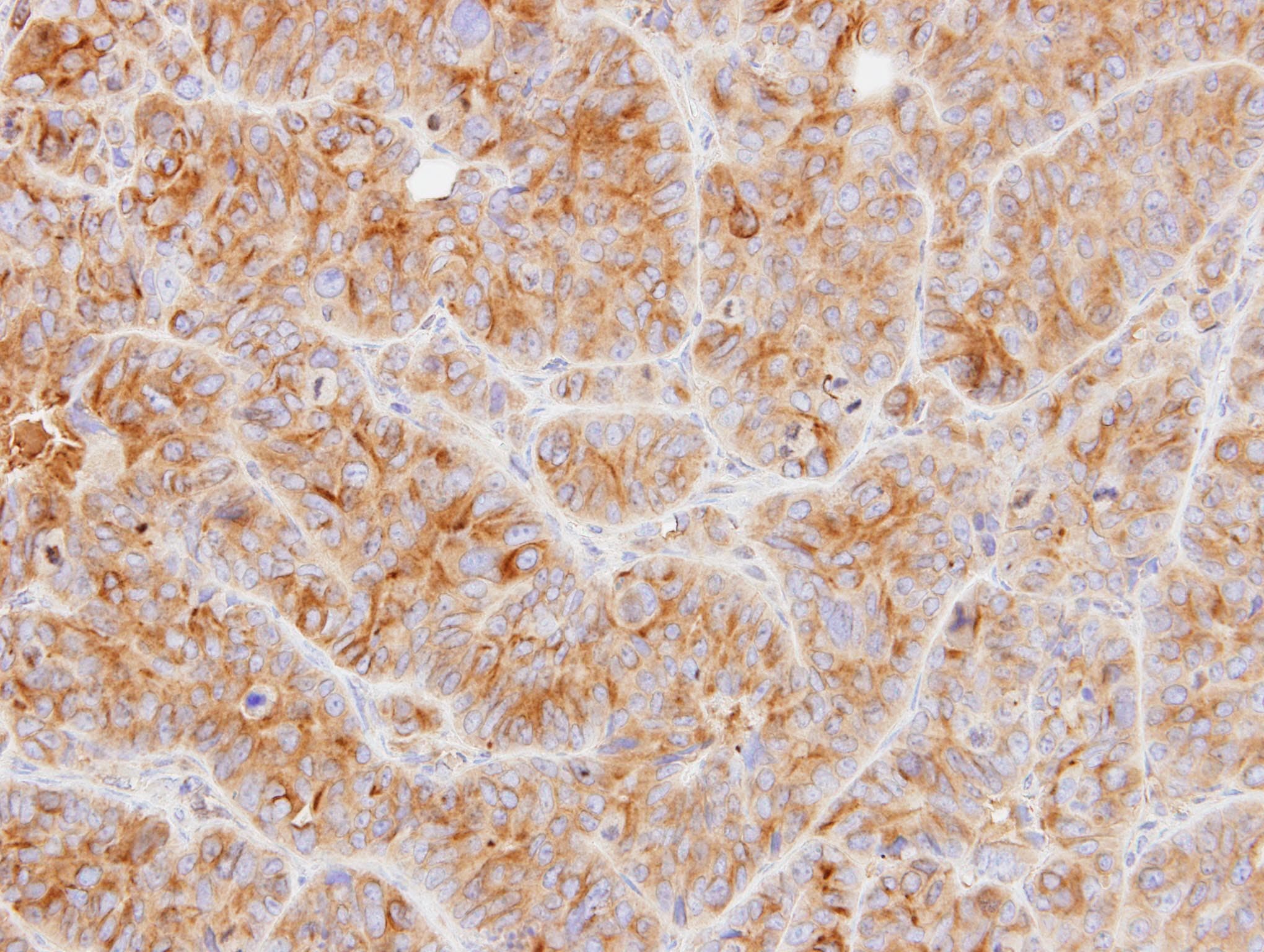 Polyclonal Rabbit anti-Human Alpha Tubulin Antibody (aa118-365, IHC, WB)