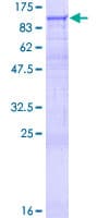 Human DGKG Protein (Recombinant GST)