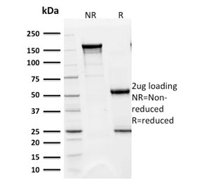 BAP1 Antibody (clone BAP1/2432)